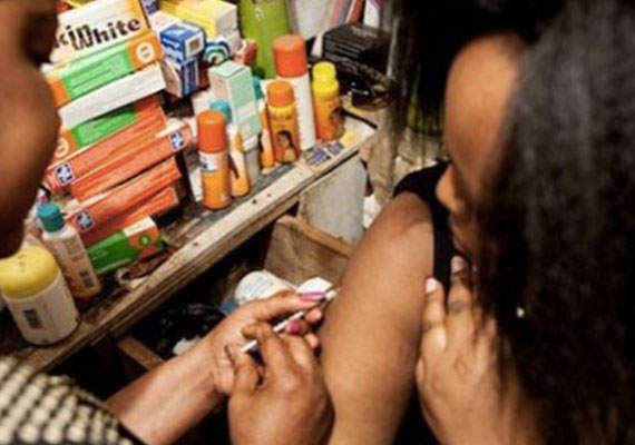 Dépigmentation par injection, quand viennent les conséquences