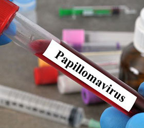 Le papillomavirus, le cancer sexuellement transmissible